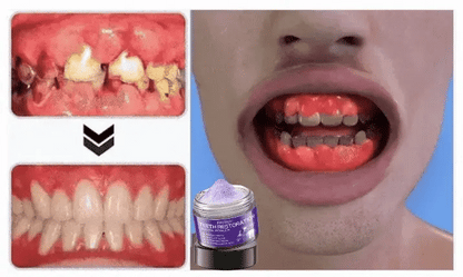 Whitening & enamel strengthening repair powder