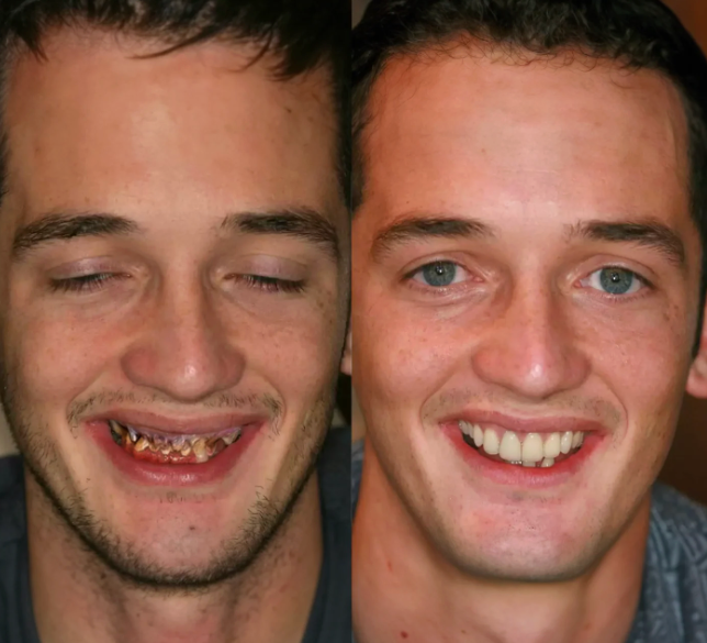 Whitening & enamel strengthening repair powder