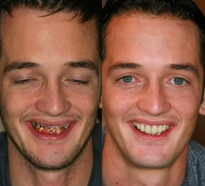 Whitening & enamel strengthening repair powder