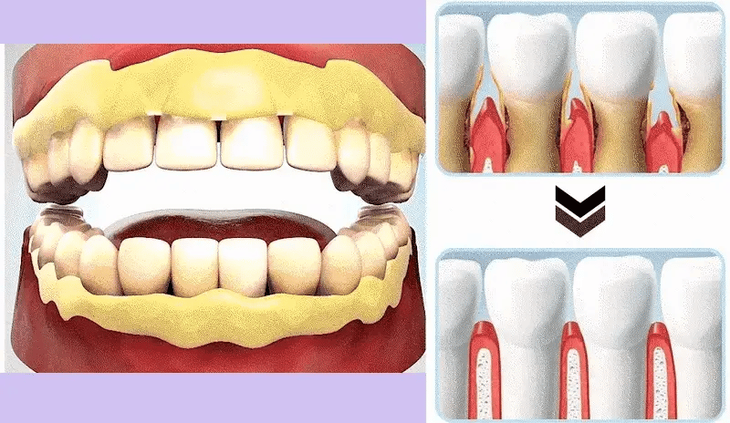 enamel gif.webp__PID:9e58e21e-9a3c-422d-8c85-30216afe7e61